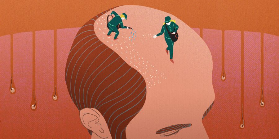 Hair loss – editorial for Göteborgs-Posten