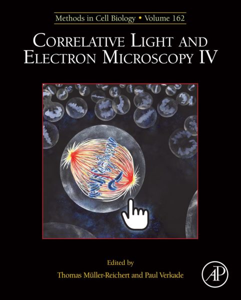 Correlative Light and Electron Microscopy